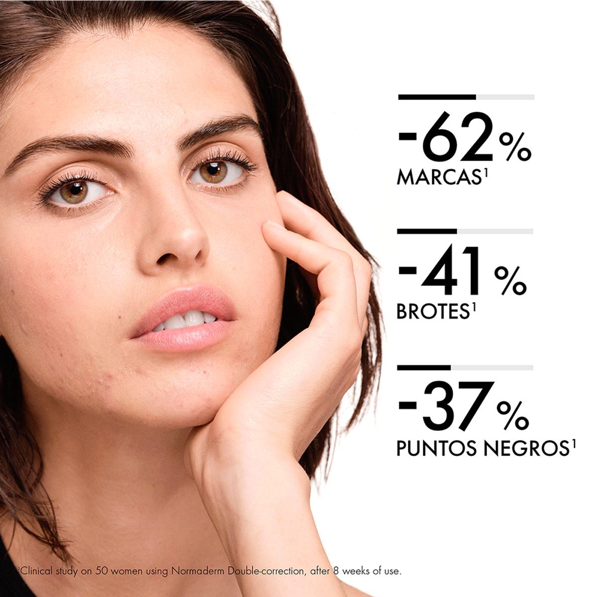 Buy Vichy Normaderm Double-correction Fluid at Best Price Online in UAE - Glow Beauty