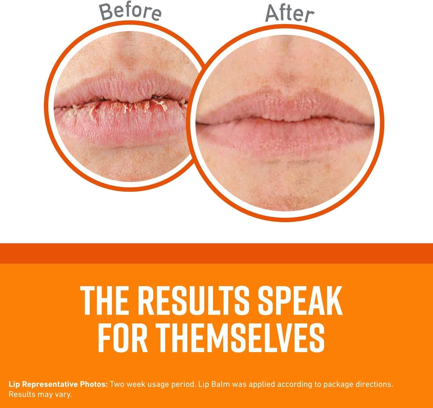 Buy O'keefe's - Lip Repair Stick Unscented Orange Combo at Best Price Online in UAE - Glow Beauty