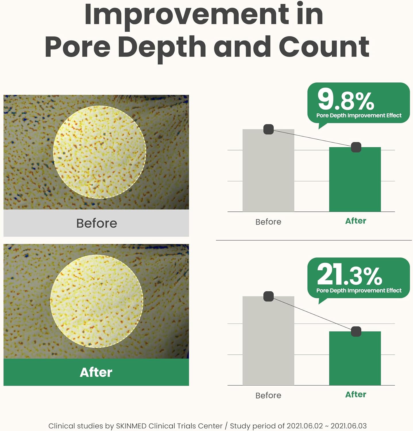 Buy AXIS-Y – Mugwort Pore Clarifying Wash Off Pack at Best Price Online in UAE - Glow Beauty