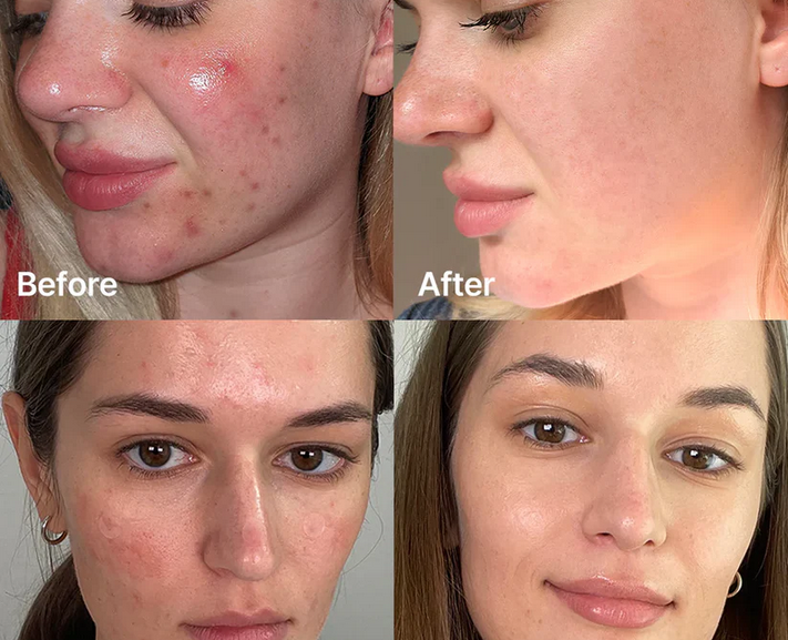 Buy Medicube Red Succinic Acid Serum - 30ml at Best Price Online in UAE - Glow Beauty