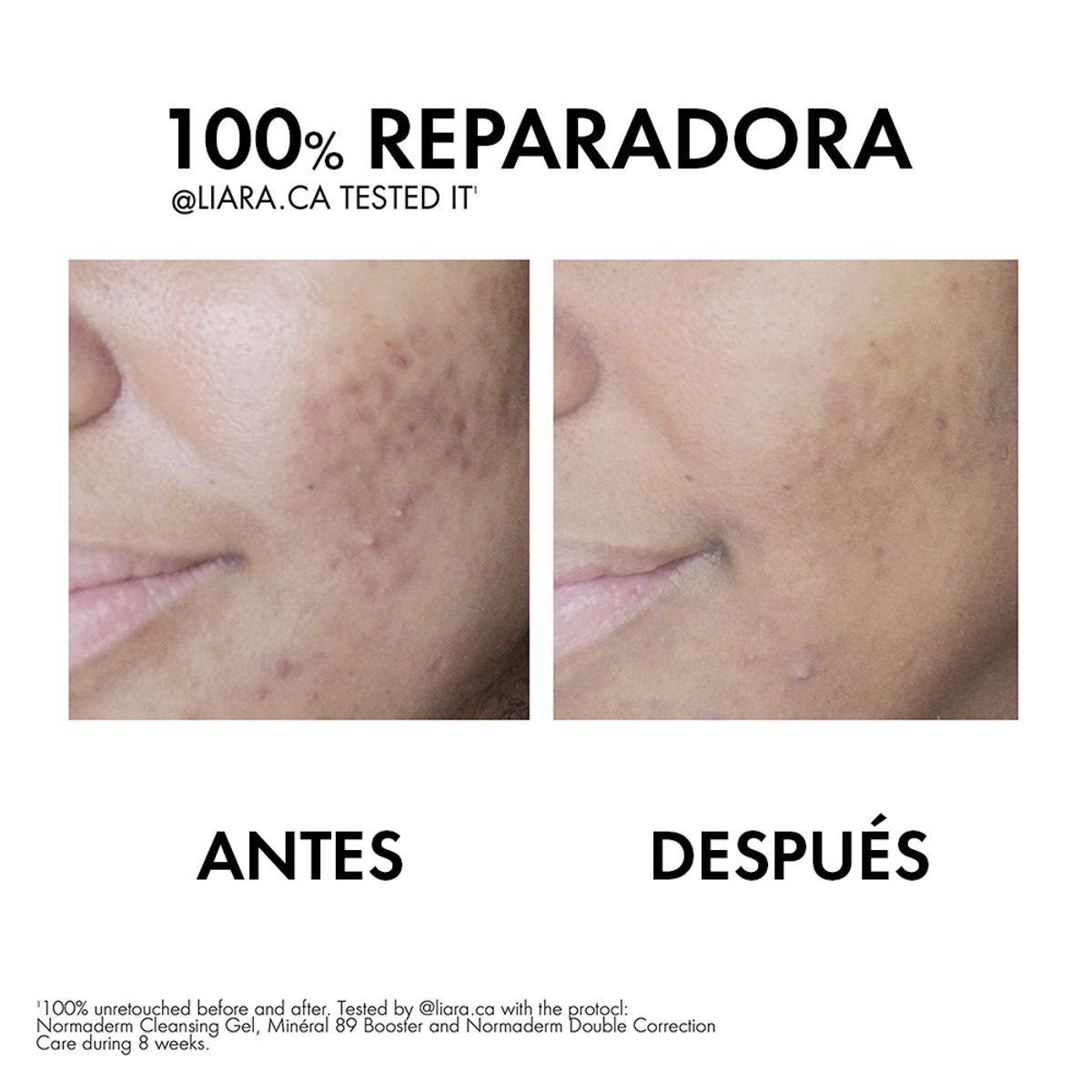 Buy Vichy Normaderm Double-correction Fluid at Best Price Online in UAE - Glow Beauty