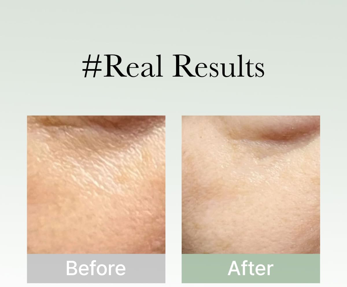 Buy Arencia – Holy Hyssop Serum 30 50ml at Best Price Online in UAE - Glow Beauty