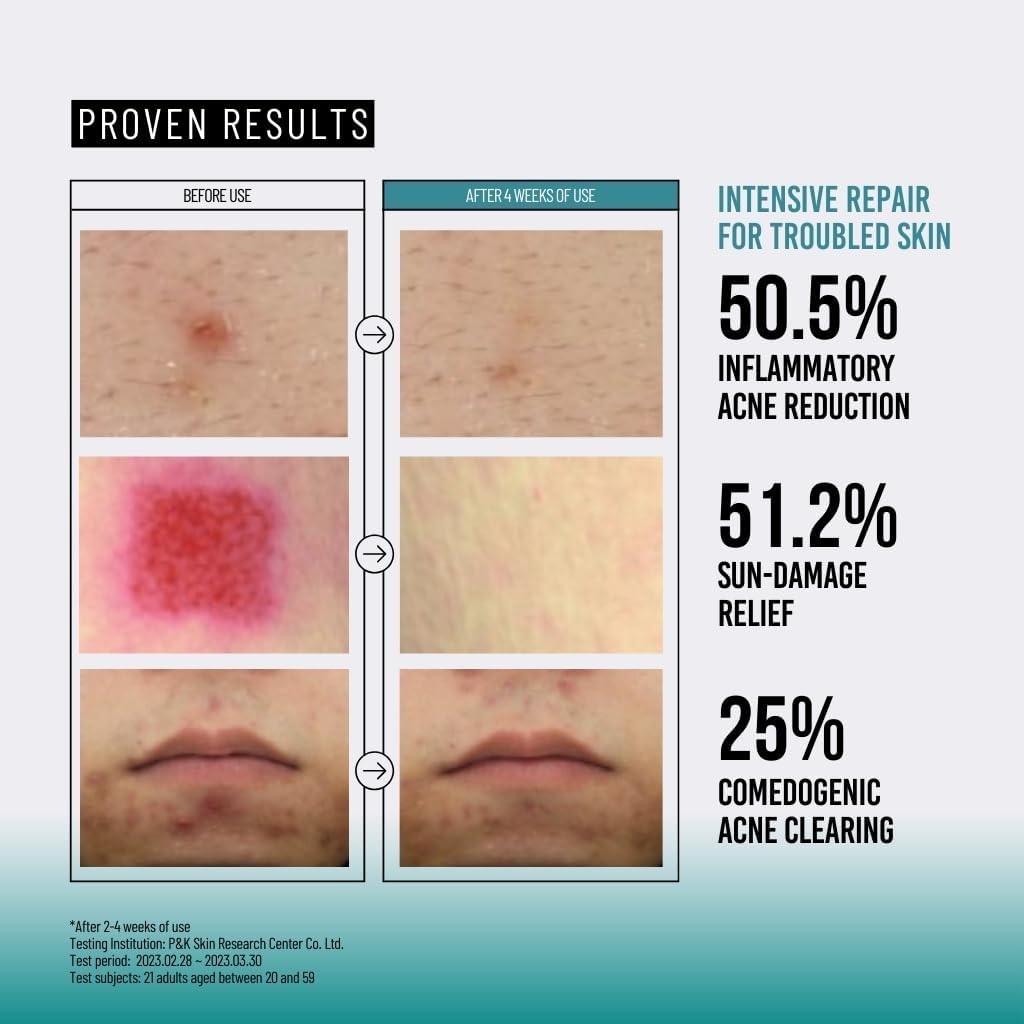 Buy JUMISO Snail Mucin 95% + Peptide Essence | 140ml at Best Price Online in UAE - Glow Beauty