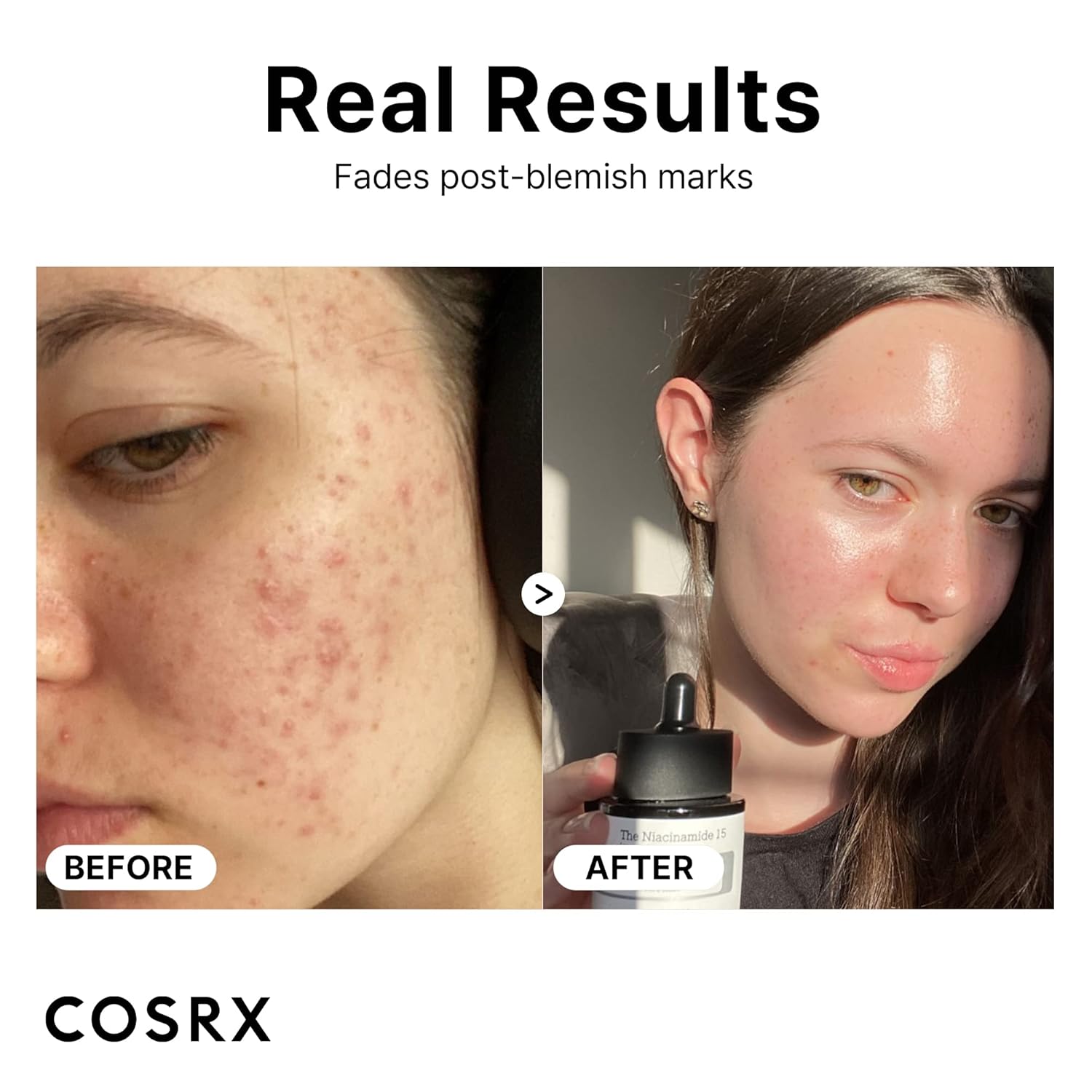 Cosrx - 15% Niacinamide Pore Minimizer Face Serum - 20ml