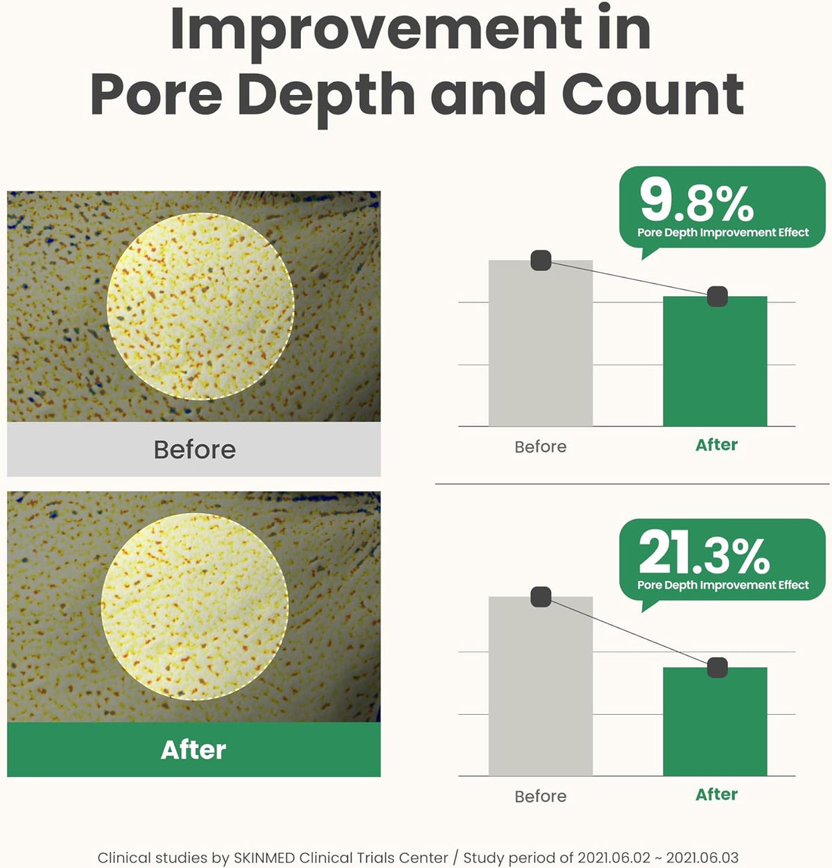 Buy AXIS-Y – Mugwort Pore Clarifying Wash Off Pack at Best Price Online in UAE - Glow Beauty