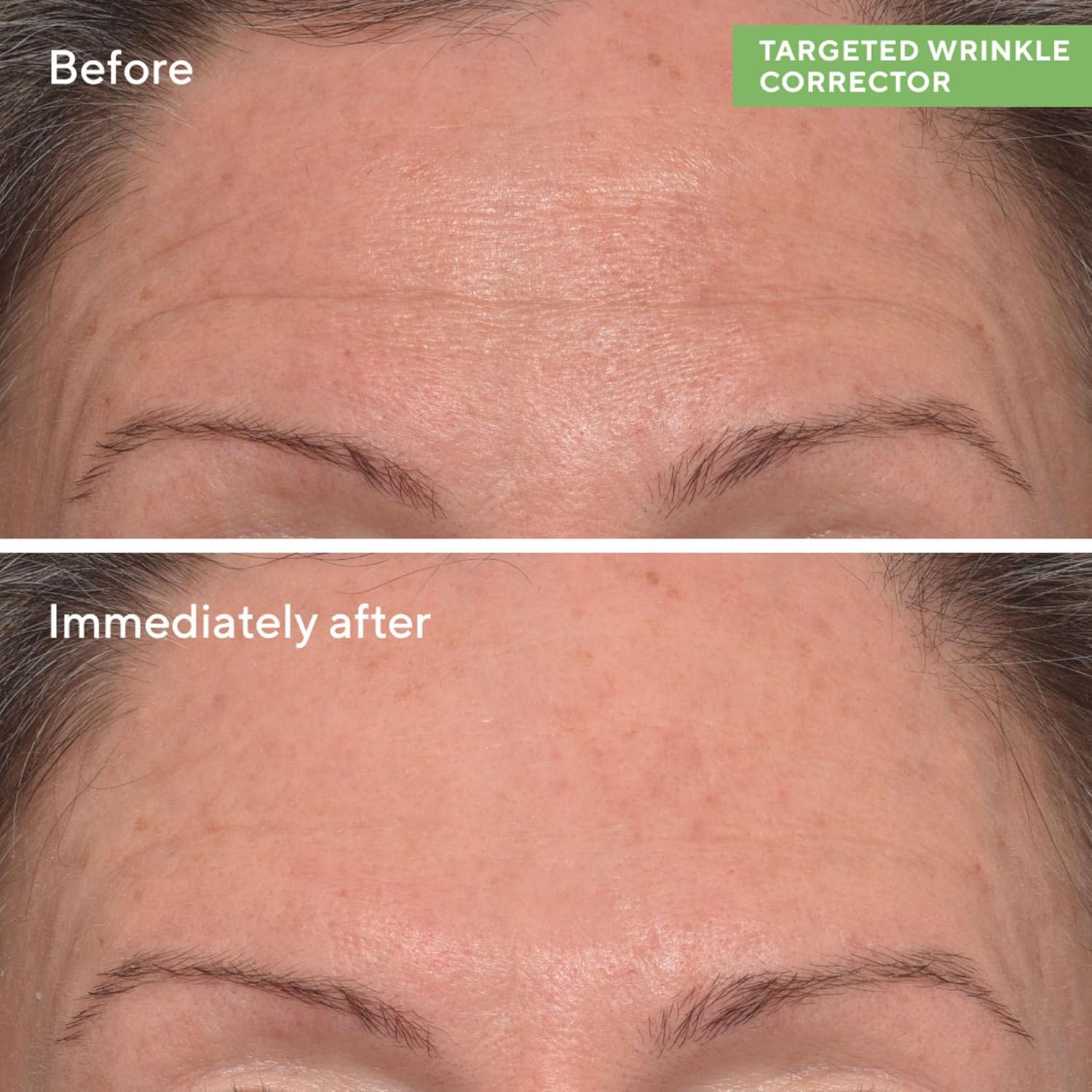 Murad Targeted Wrinkle Corrector – 15ml