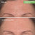 Murad Targeted Wrinkle Corrector – 15ml