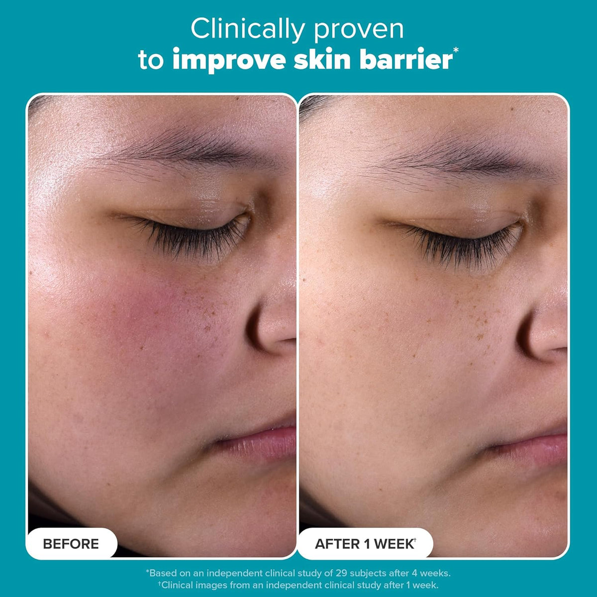 Buy Paula's Choice - Skin Perfecting 2% BHA Liquid Exfoliant at Best Price Online in UAE - Glow Beauty