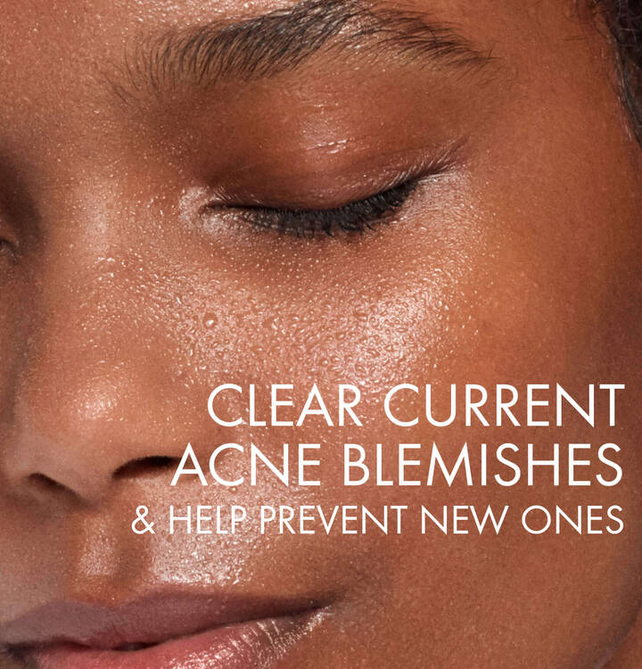 Buy Vichy Normaderm Phytosolution Intensive Purifying Gel Cleanser at Best Price Online in UAE - Glow Beauty