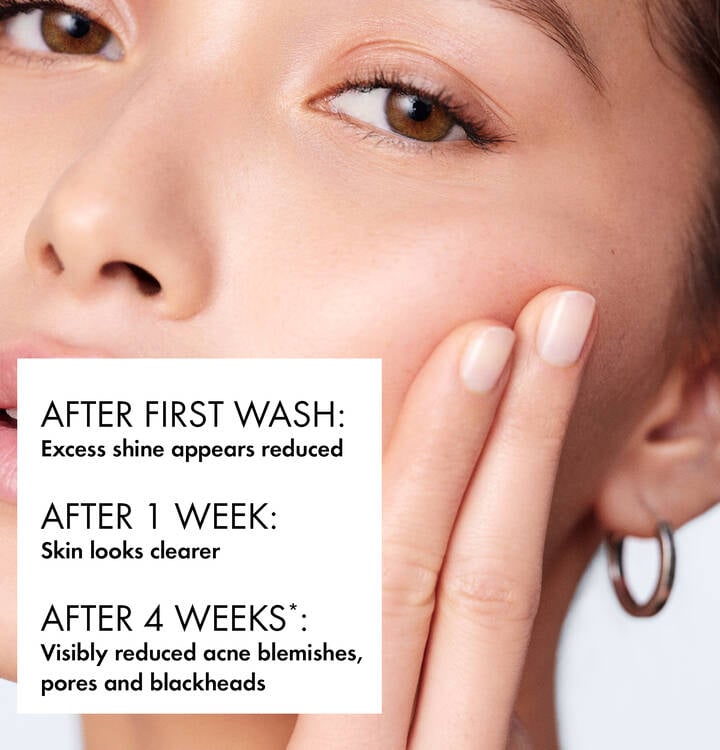 Buy Vichy Normaderm Phytosolution Intensive Purifying Gel Cleanser at Best Price Online in UAE - Glow Beauty