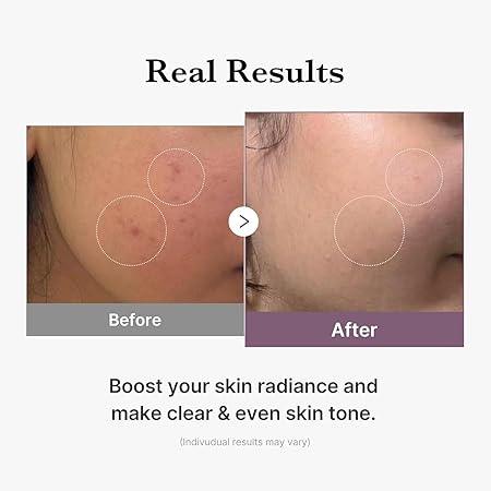 Medicube Age - R Glutathione Glow Toner – 140ml - Glow Beauty