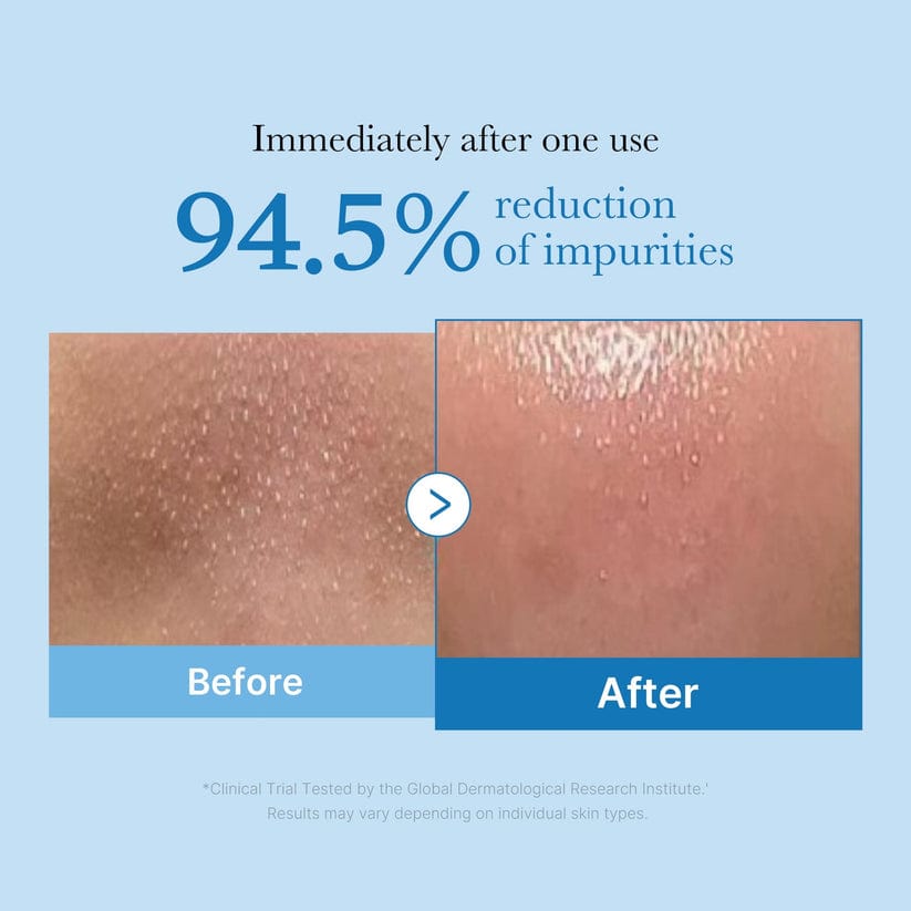 Medicube Zero Pore Cleansing Oil - 205ml