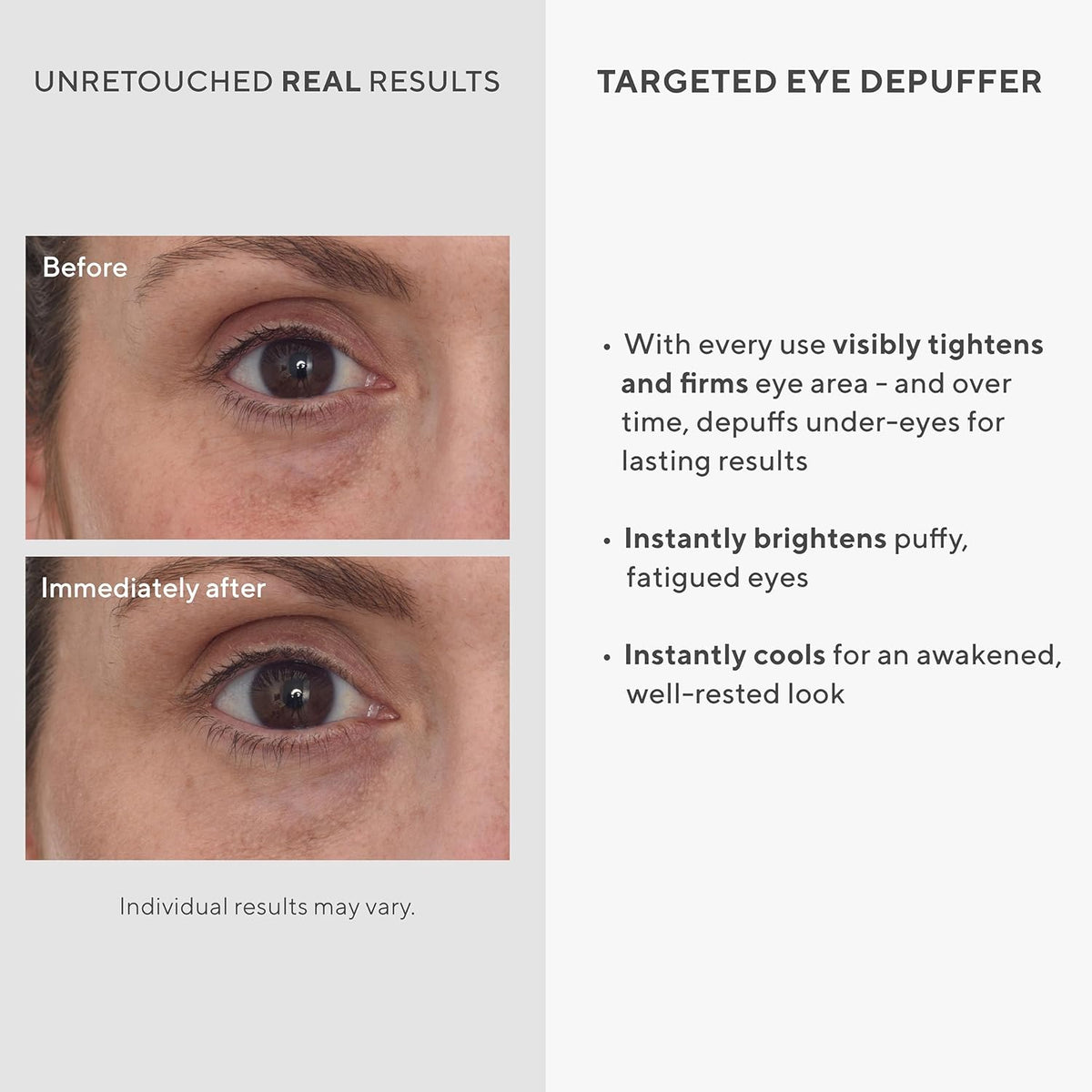 Murad Targeted Eye Depuffer - Glow Beauty