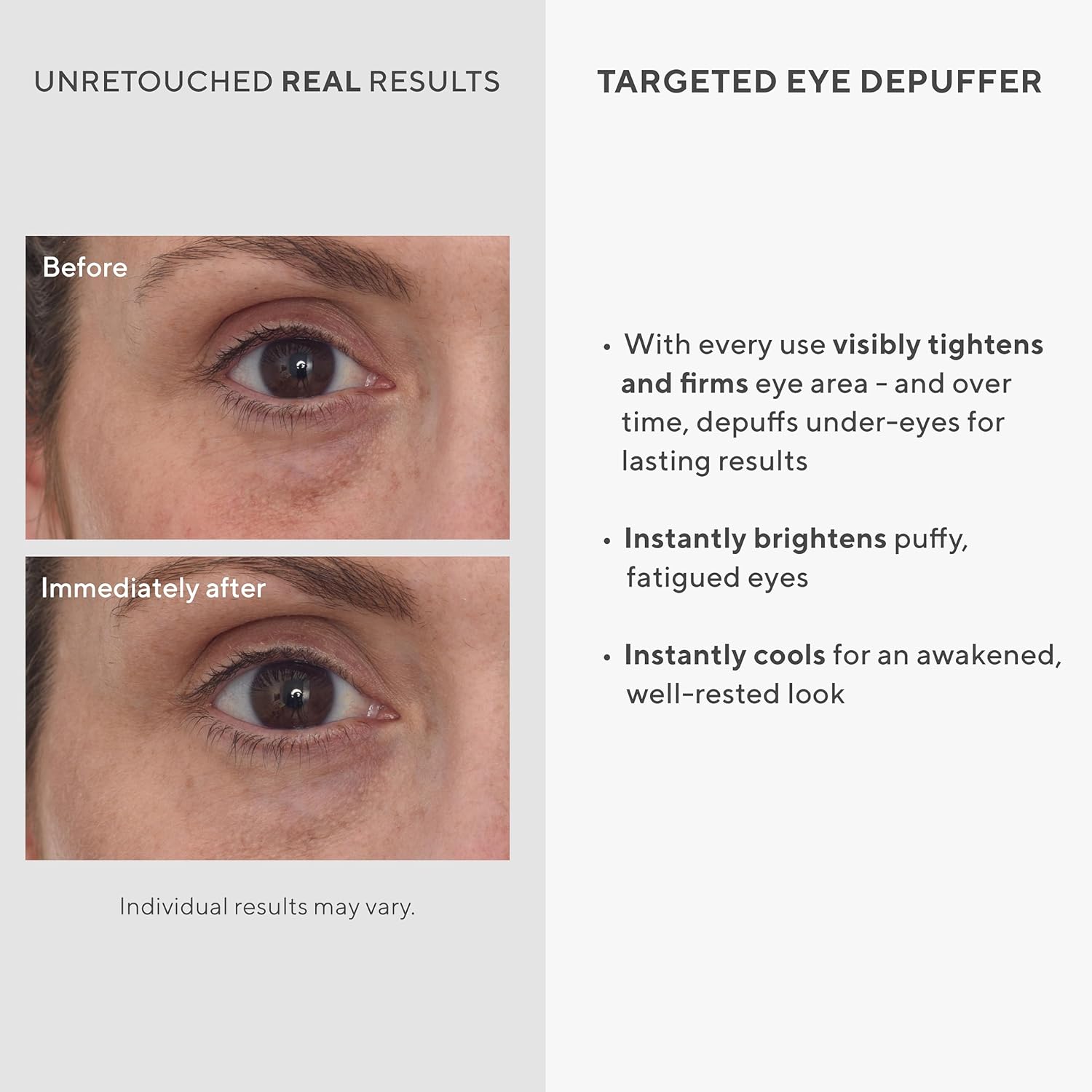 Murad Targeted Eye Depuffer - Glow Beauty