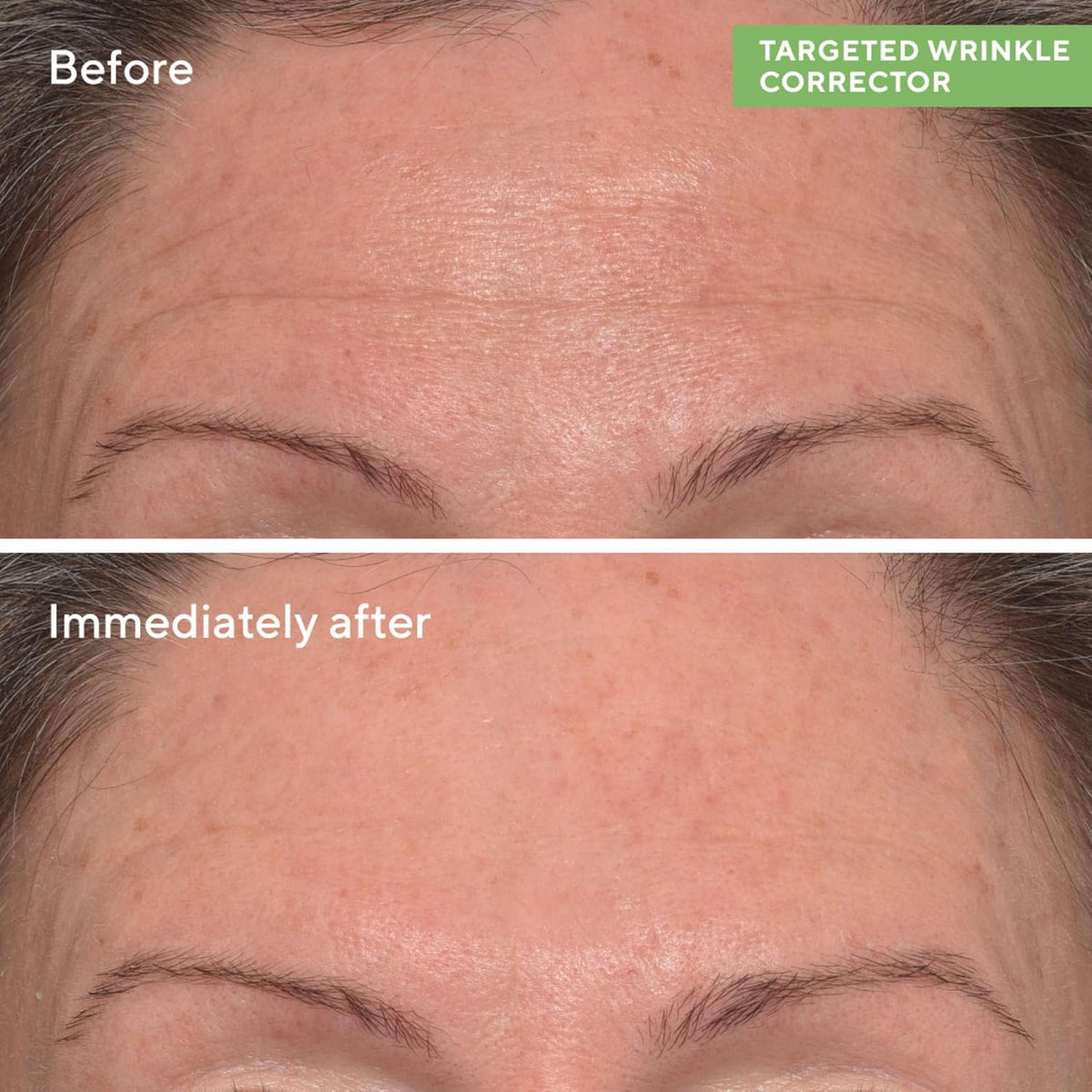 Murad Targeted Wrinkle Corrector – 15ml - Glow Beauty